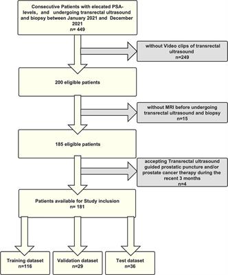 Machine learning prediction of prostate cancer from transrectal ultrasound video clips